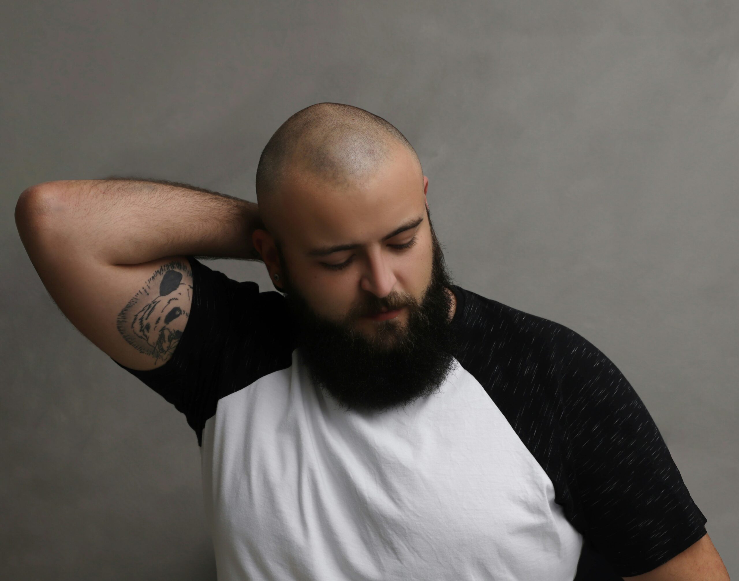 Male Pattern Hair Loss Treatment Male Pattern Hair Loss Treatment
